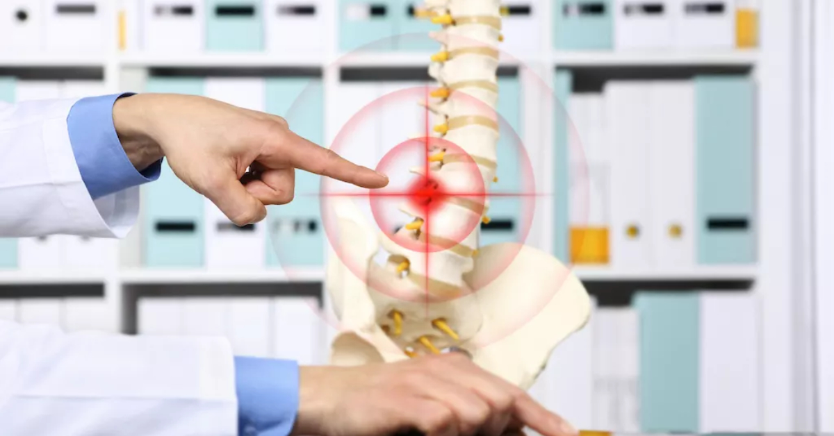 Do you suffer from lumbar spine pain? It may be radicular syndrome
